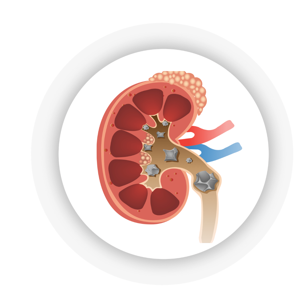KIDNEY UROLOGY 3